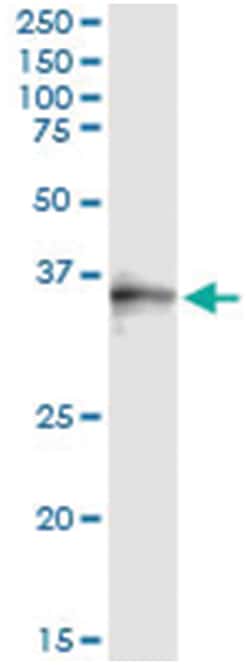 SNX11, Human, IP-WB Antibody Pair (PW2), Abnova&trade;