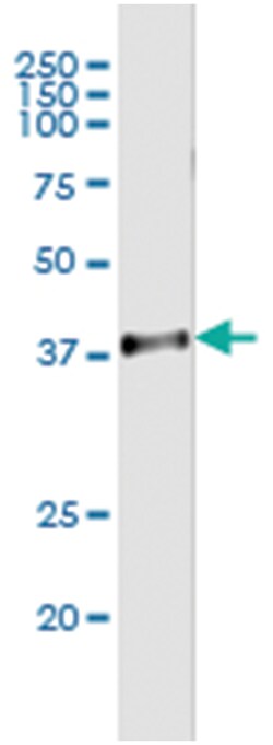SNX11, Human, IP-WB Antibody Pair (PW3), Abnova&trade;