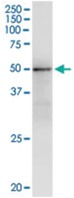 anti-GMPPA, Human, IP-WB Antibody Pair, Abnova 1 Set:Antibodies, Monoclonal/Polyclonal
