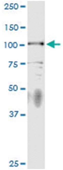 anti-PKN3, Human, IP-WB Antibody Pair, Abnova&trade;