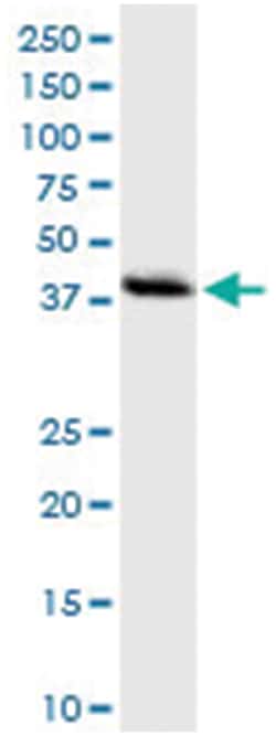 anti-DNMT3L, Human, IP-WB Antibody Pair, Abnova&trade;