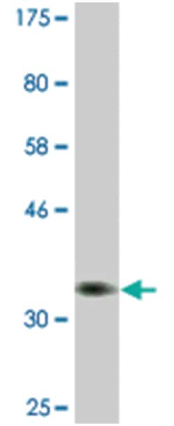 PSAT1, Mouse, Clone: 1C2, Abnova 200&mu;L; Unlabeled:Antibodies, Monoclonal
