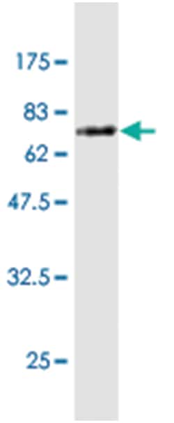 EFEMP2, Mouse, Clone: 2F12, Abnova 100 &mu;g | Buy Online | Abnova | Fisher Scientific