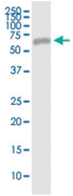 EFEMP2, Human, IP-WB Antibody Pair (PW3), Abnova 1 Set:Antibodies, Monoclonal/Polyclonal