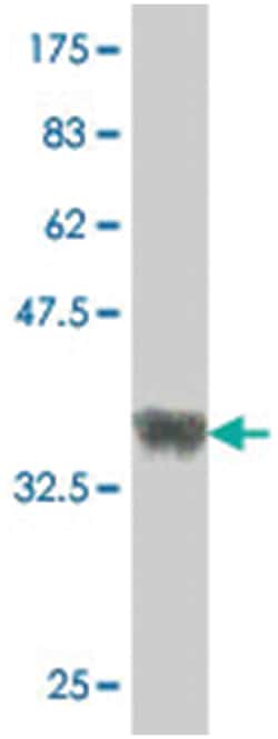 TLX3, Mouse, Polyclonal Antibody, Abnova 50 &mu;L | Buy Online | Abnova Corporation | Fisher Scientific