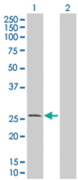 KCNIP1 293T Cell Overexpression Lysate (Denatured), Abnova 100 &mu;L | Buy Online | Abnova | Fisher Scientific