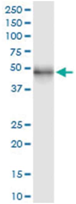 Abnova CD209, Human, IP-WB Antibody Pair (PW1), Abnova™