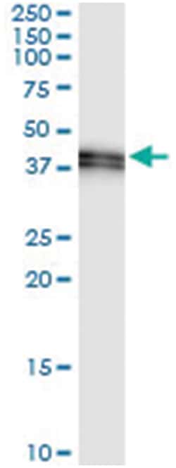 anti-STOML2, Human, IP-WB Antibody Pair, Abnova&trade;