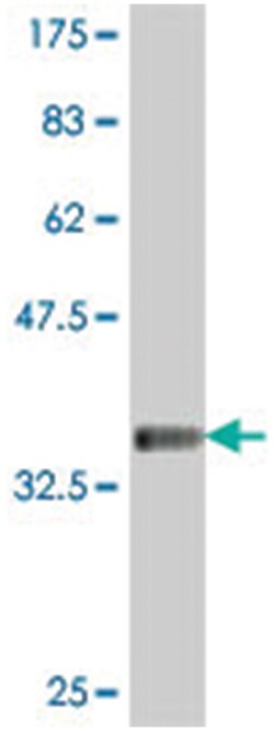 PLA2G3, Mouse, Polyclonal Antibody, Abnova 50 &mu;L | Buy Online | Abnova | Fisher Scientific