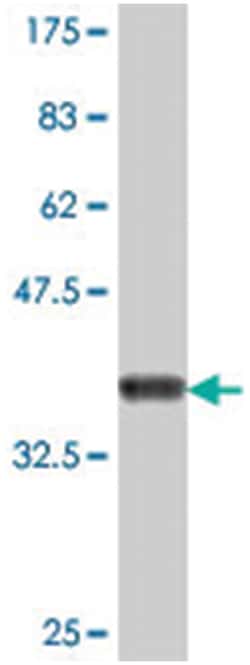 COL5A3, Mouse, Polyclonal Antibody, Abnova 50&mu;L; Unlabeled:Antibodies,