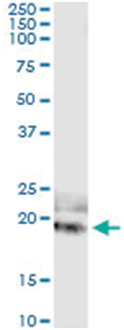 anti-IL20, Human, IP-WB Antibody Pair, Abnova&trade;