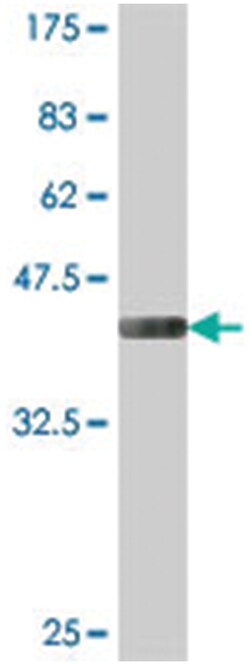 GALNT9, Mouse, Polyclonal Antibody, Abnova 50 &mu;L | Buy Online | Abnova Corporation | Fisher Scientific