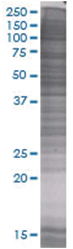 ARHGEF3 293T Cell Overexpression Lysate (Denatured), Abnova