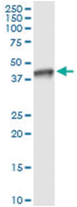 anti-NSDHL, Human, IP-WB Antibody Pair, Abnova&trade;