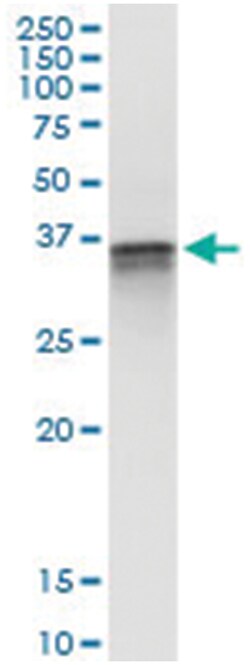 anti-F11R, Human, IP-WB Antibody Pair, Abnova™