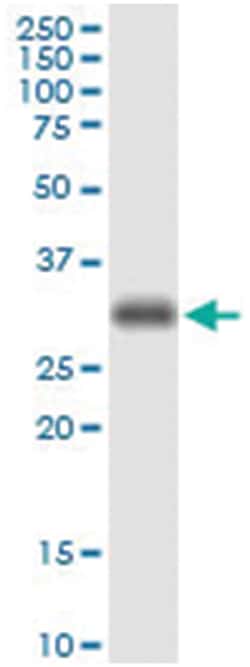 PARD6A, Human, IP-WB Antibody Pair (PW1), Abnova&trade;