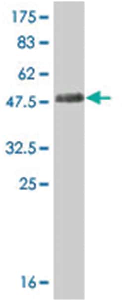 STMN3, Mouse, Clone: 1F2, Abnova 200&mu;L; Unlabeled:Antibodies, Monoclonal