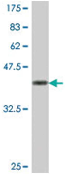 HEBP1, Mouse, Polyclonal Antibody, Abnova 50 &mu;L | Buy Online | Abnova Corporation | Fisher Scientific