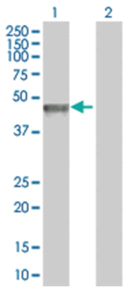 FOXP3 293T Cell Overexpression Lysate (Denatured), Abnova