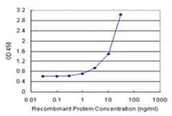 anti-TPRKB Matched Antibody Pair, Abnova