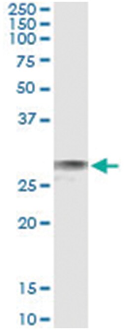 EXOSC3, Human, IP-WB Antibody Pair (PW2), Abnova 1 Set:Antibodies, Monoclonal/Polyclonal