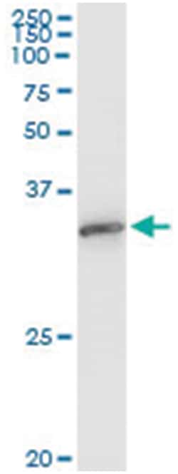 EXOSC3, Human, IP-WB Antibody Pair (PW3), Abnova&trade;