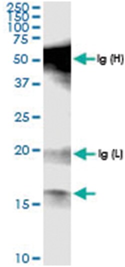anti-POLR1D, Human, IP-WB Antibody Pair, Abnova 1 Set:Antibodies, Monoclonal/Polyclonal