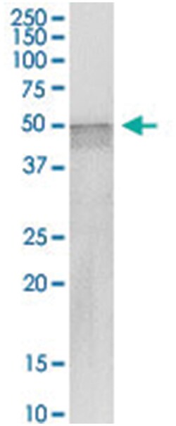 anti-YBX2, Human, IP-WB Antibody Pair, Abnova 1 Set:Antibodies, Monoclonal/Polyclonal