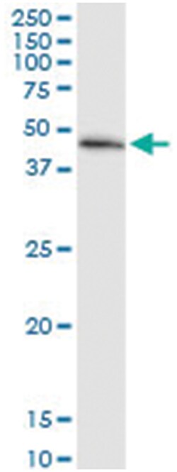 anti-MECR, Human, IP-WB Antibody Pair, Abnova&trade;