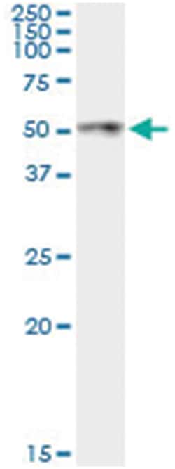 anti-ANGPTL4, Human, IP-WB Antibody Pair, Abnova 1 Set:Antibodies, Monoclonal/Polyclonal