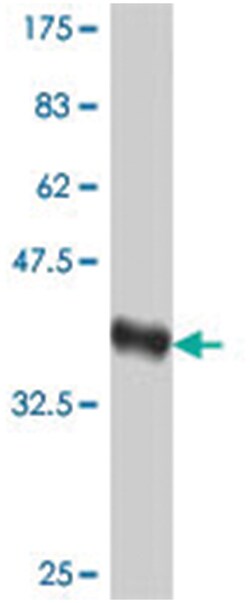 RNF12, Mouse, Polyclonal Antibody, Abnova 50 &mu;L | Buy Online | Abnova | Fisher Scientific