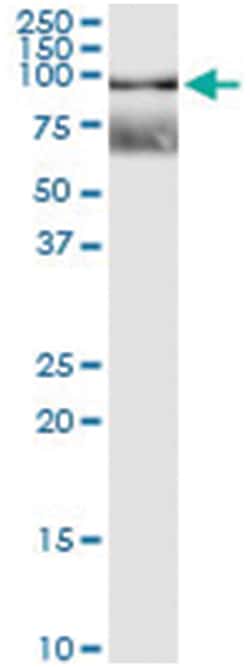 RNF12, Human, IP-WB Antibody Pair (PW2), Abnova&trade;