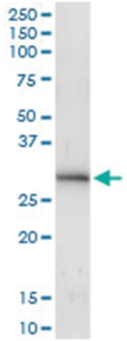 anti-ING4, Human, IP-WB Antibody Pair, Abnova™