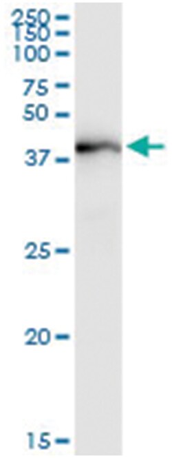 anti-AADAT, Human, IP-WB Antibody Pair, Abnova&trade;