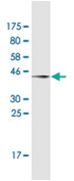 CYB5R4, Mouse, Clone: 4B8, Abnova 200&mu;L; Unlabeled:Antibodies, Monoclonal