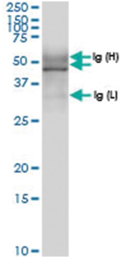 TUBD1, Human, IP-WB Antibody Pair (PW1), Abnova™
