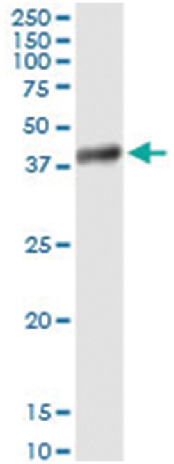 anti-HAO2, Human, IP-WB Antibody Pair, Abnova&trade;