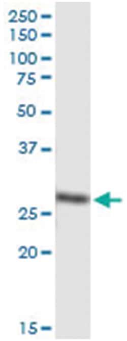 anti-DCXR, Human, IP-WB Antibody Pair, Abnova&trade;