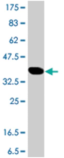 HERC5, Mouse, Polyclonal Antibody, Abnova 50&mu;L; Unlabeled:Antibodies,