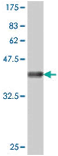 GLTP, Mouse, Polyclonal Antibody, Abnova 50&mu;L; Unlabeled:Antibodies,
