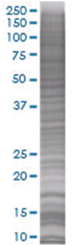PACAP 293T Cell Overexpression Lysate (Denatured), Abnova 100 &mu;L | Buy Online | Abnova | Fisher Scientific