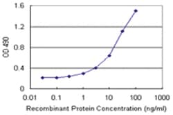 RNF181, Human, Matched Antibody Pair (AP11), Abnova&trade;