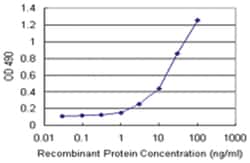 RNF181, Human, Matched Antibody Pair (AP21), Abnova™
