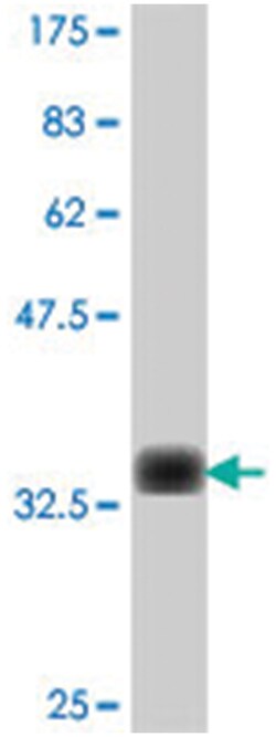 MARCH2., Mouse, Polyclonal Antibody, Abnova 50&mu;L; Unlabeled:Antibodies,