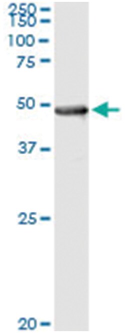 anti-PIPOX, Human, IP-WB Antibody Pair, Abnova 1 Set:Antibodies, Monoclonal/Polyclonal