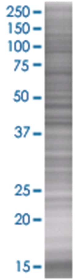PIPOX 293T Cell Overexpression Lysate (Denatured), Abnova 100 &mu;L | Buy Online | Abnova | Fisher Scientific
