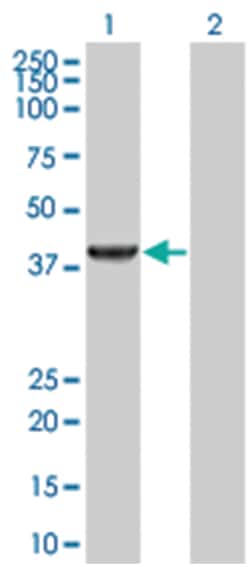 PIPOX 293T Cell Overexpression Lysate (Denatured), Abnova 100 &mu;L | Buy Online | Abnova | Fisher Scientific