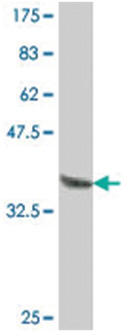 IER5, Mouse, Polyclonal Antibody, Abnova 50 &mu;L | Buy Online | Abnova Corporation | Fisher Scientific