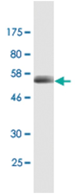 CD320, Mouse, Clone: 4F2, Abnova 200&mu;L; Unlabeled:Antibodies, Monoclonal