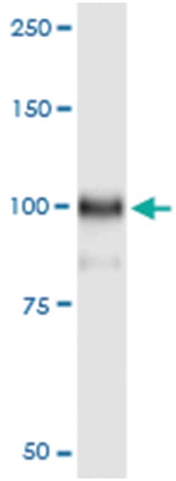anti-HOOK1, Human, IP-WB Antibody Pair, Abnova&trade;